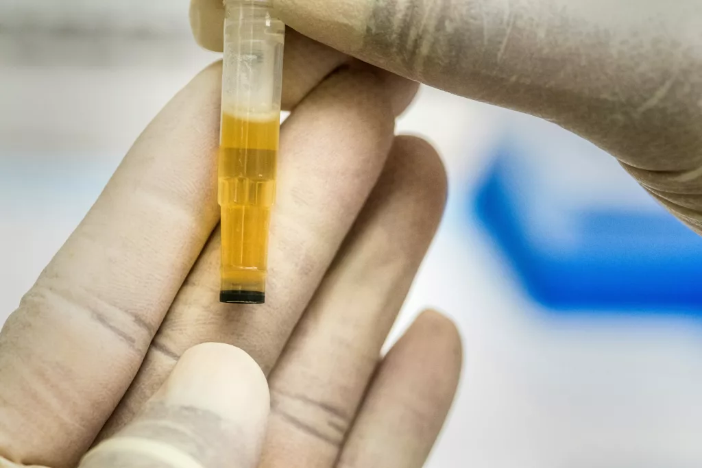 préparation test mycotoxines urinaires Microbiome Renaissance